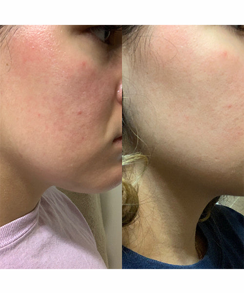 Skin result 1