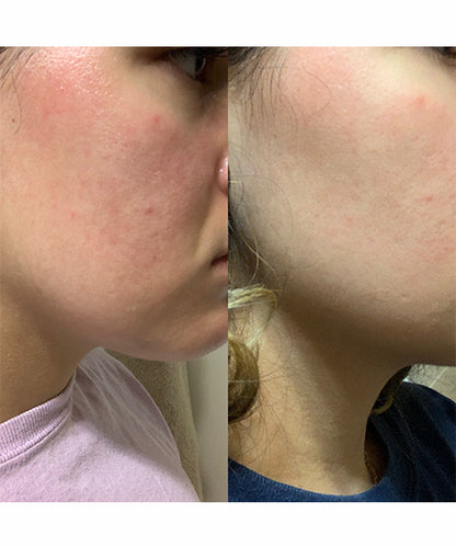 Skin result 1